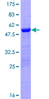 DUPD1 Protein - 12.5% SDS-PAGE of human DUPD1 stained with Coomassie Blue