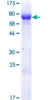 DUS1L Protein - 12.5% SDS-PAGE of human DUS1L stained with Coomassie Blue