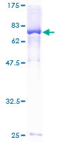 DUS2 / DUS2L Protein - 12.5% SDS-PAGE of human FLJ20399 stained with Coomassie Blue