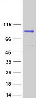 DUS3L Protein - Purified recombinant protein DUS3L was analyzed by SDS-PAGE gel and Coomassie Blue Staining