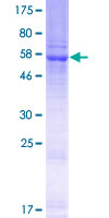 DUS4L Protein - 12.5% SDS-PAGE of human DUS4L stained with Coomassie Blue