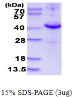 DUSP10 / MKP5 Protein