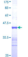 DUSP12 Protein - 12.5% SDS-PAGE Stained with Coomassie Blue.