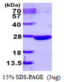 DUSP13 Protein