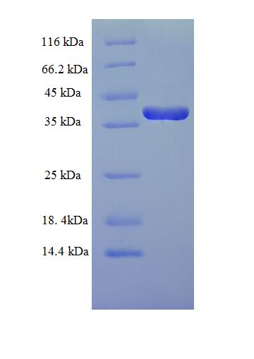 DUSP13 Protein