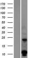 DUSP15 Protein - Western validation with an anti-DDK antibody * L: Control HEK293 lysate R: Over-expression lysate