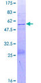 DUSP15 Protein - 12.5% SDS-PAGE of human DUSP15 stained with Coomassie Blue