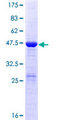 DUSP18 Protein - 12.5% SDS-PAGE of human DUSP18 stained with Coomassie Blue