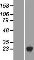 DUSP19 / SKRP1 Protein - Western validation with an anti-DDK antibody * L: Control HEK293 lysate R: Over-expression lysate