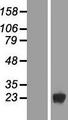 DUSP19 / SKRP1 Protein - Western validation with an anti-DDK antibody * L: Control HEK293 lysate R: Over-expression lysate