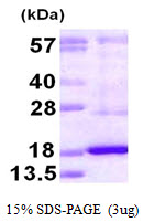 DUSP19 / SKRP1 Protein