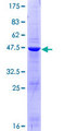 DUSP21 Protein - 12.5% SDS-PAGE of human DUSP21 stained with Coomassie Blue