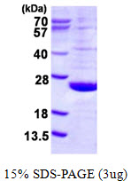 DUSP21 Protein