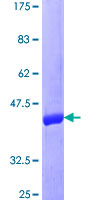 DUSP22 / JSP 1 Protein - 12.5% SDS-PAGE of human DUSP22 stained with Coomassie Blue