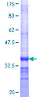 DUSP22 / JSP 1 Protein - 12.5% SDS-PAGE Stained with Coomassie Blue