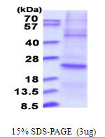DUSP22 / JSP 1 Protein