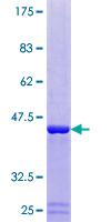 DUSP23 Protein - 12.5% SDS-PAGE of human DUSP23 stained with Coomassie Blue