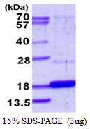 DUSP23 Protein