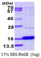 DUSP23 Protein