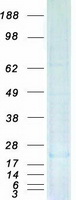 DUSP23 Protein - Purified recombinant protein DUSP23 was analyzed by SDS-PAGE gel and Coomassie Blue Staining
