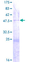 DUSP26 / MKP8 Protein - 12.5% SDS-PAGE of human DUSP26 stained with Coomassie Blue