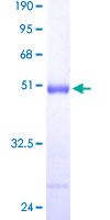 DUSP3 / VHR Protein - 12.5% SDS-PAGE of human DUSP3 stained with Coomassie Blue