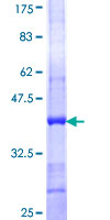 DUSP3 / VHR Protein - 12.5% SDS-PAGE Stained with Coomassie Blue.