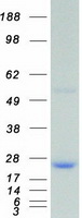 DUSP3 / VHR Protein - Purified recombinant protein DUSP3 was analyzed by SDS-PAGE gel and Coomassie Blue Staining