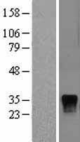 DUSP4 / MKP2 Protein - Western validation with an anti-DDK antibody * L: Control HEK293 lysate R: Over-expression lysate