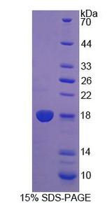 DUSP5 Protein - Recombinant Dual Specificity Phosphatase 5 By SDS-PAGE