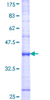 DUSP8 Protein - 12.5% SDS-PAGE Stained with Coomassie Blue.