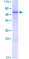 DUSP9 Protein - 12.5% SDS-PAGE of human DUSP9 stained with Coomassie Blue
