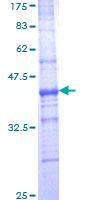 DUSP9 Protein - 12.5% SDS-PAGE Stained with Coomassie Blue.