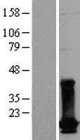 DUT / DUTPase Protein - Western validation with an anti-DDK antibody * L: Control HEK293 lysate R: Over-expression lysate
