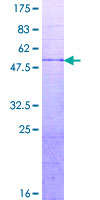 DUT / DUTPase Protein - 12.5% SDS-PAGE of human DUT stained with Coomassie Blue