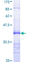 DUT / DUTPase Protein - 12.5% SDS-PAGE Stained with Coomassie Blue.
