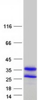 DUT / DUTPase Protein - Purified recombinant protein DUT was analyzed by SDS-PAGE gel and Coomassie Blue Staining