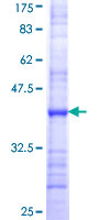 DUX3 Protein - 12.5% SDS-PAGE Stained with Coomassie Blue.