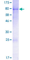 DVL1 / DVL / Dishevelled Protein - 12.5% SDS-PAGE of human DVL1 stained with Coomassie Blue