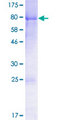 DVL1 / DVL / Dishevelled Protein - 12.5% SDS-PAGE of human DVL1 stained with Coomassie Blue