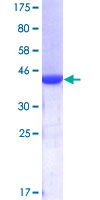 DVL1 / DVL / Dishevelled Protein - 12.5% SDS-PAGE Stained with Coomassie Blue