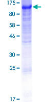 DVL2 / Dishevelled 2 Protein - 12.5% SDS-PAGE of human DVL2 stained with Coomassie Blue