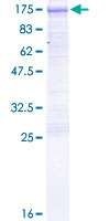 DVL3 / Dishevelled 3 Protein - 12.5% SDS-PAGE of human DVL3 stained with Coomassie Blue