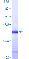 DVL3 / Dishevelled 3 Protein - 12.5% SDS-PAGE Stained with Coomassie Blue