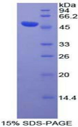 DVL3 / Dishevelled 3 Protein - Recombinant Dishevelled, Dsh Homolog 3 By SDS-PAGE