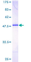 DYDC1 Protein - 12.5% SDS-PAGE of human LOC143241 stained with Coomassie Blue