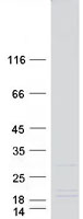 DYDC1 Protein - Purified recombinant protein DYDC1 was analyzed by SDS-PAGE gel and Coomassie Blue Staining