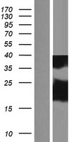 DYDC2 Protein - Western validation with an anti-DDK antibody * L: Control HEK293 lysate R: Over-expression lysate