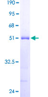 DYDC2 Protein - 12.5% SDS-PAGE of human MGC16186 stained with Coomassie Blue
