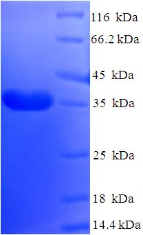 DYDC2 Protein